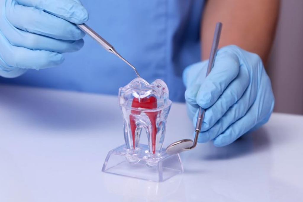 Endodontista na Zona Leste | OdontoImpo