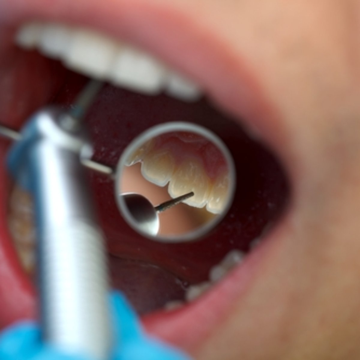 Endodontista na Zona Leste
